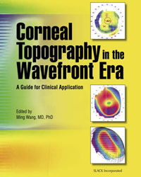 corneal topography